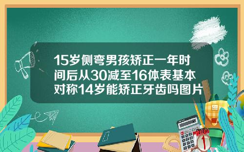15岁侧弯男孩矫正一年时间后从30减至16体表基本对称14岁能矫正牙齿吗图片